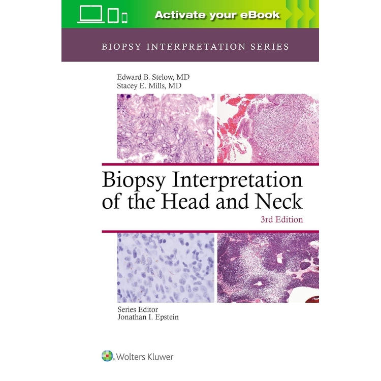 Biopsy Interpretation of the Head and Neck, 3rd Edition