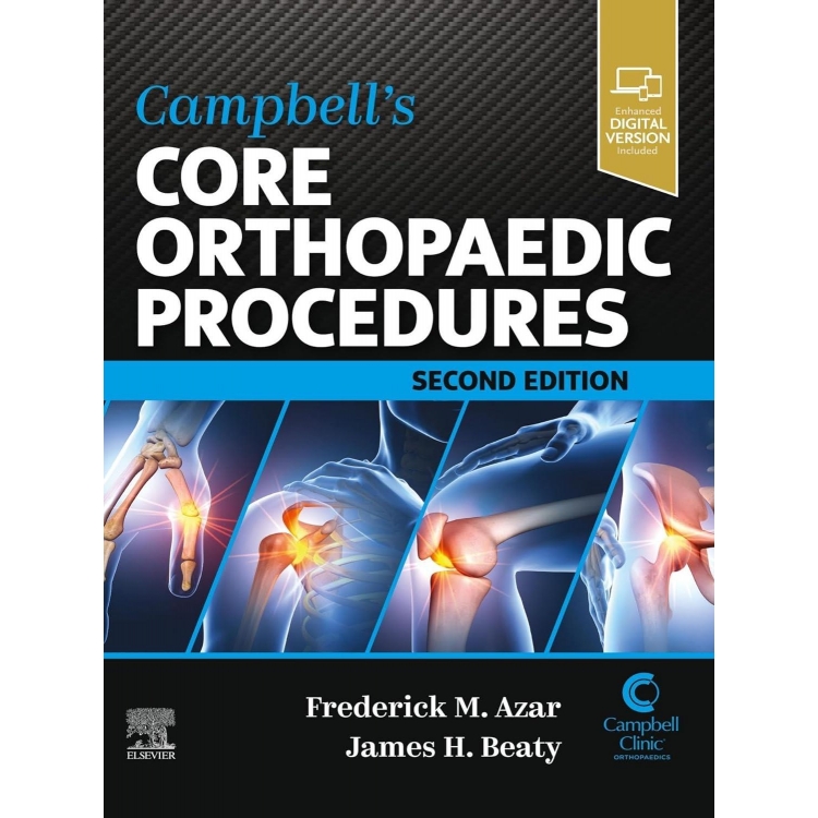 Campbell`s Core Orthopaedic Procedures, 2nd Edition