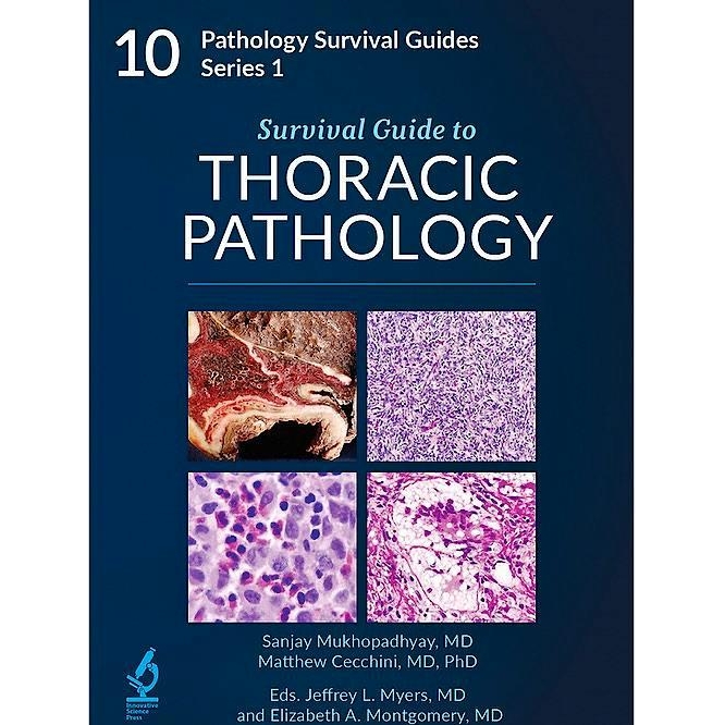 Survival Guide to Thoracic Pathology