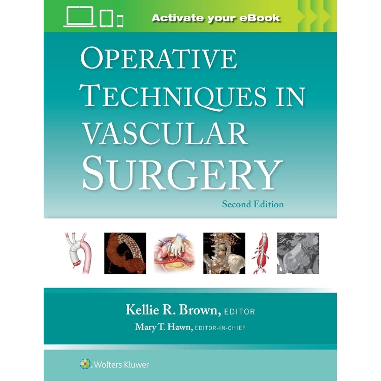Operative Techniques in Vascular Surgery, 2nd Edition