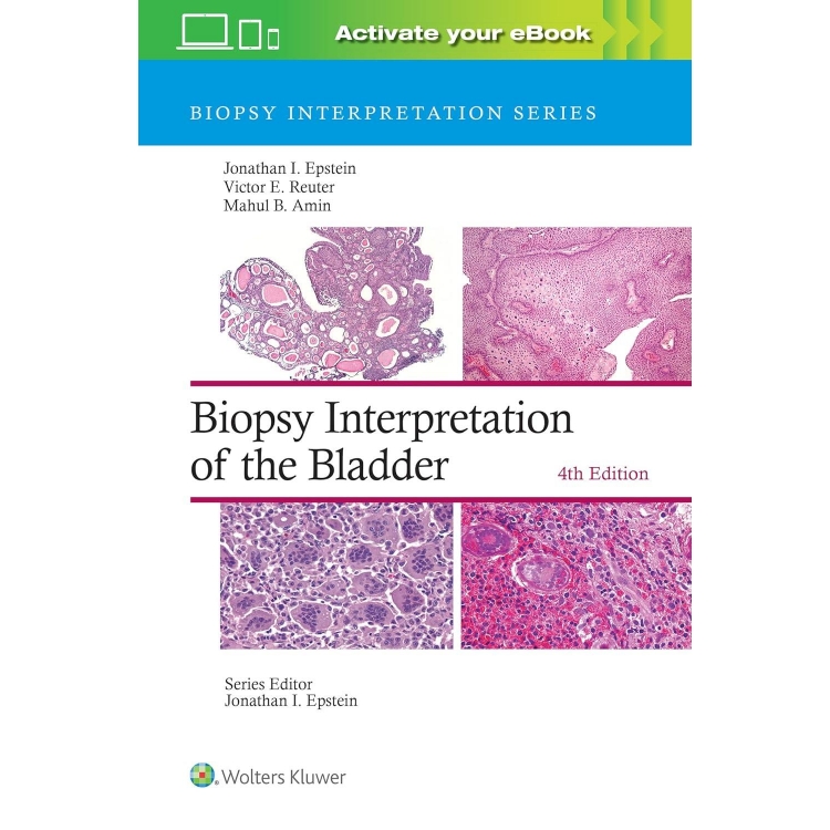 Biopsy Interpretation of the Bladder: Print + eBook with Multimedia, 4th Edition