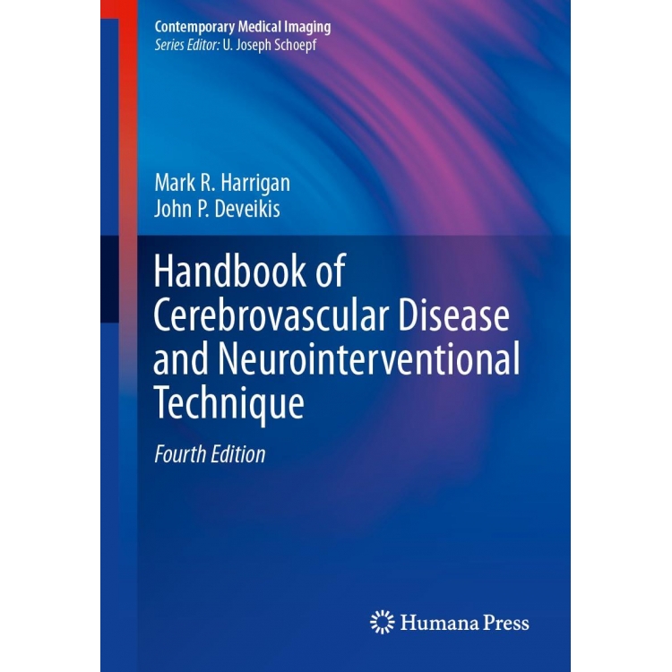 Handbook of Cerebrovascular Disease and Neurointerventional Technique, 4rd Edition