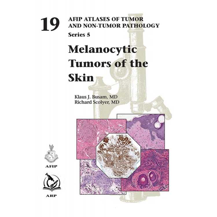 AFIP Atlases of Tumor and Non-tumor Pathology, Series 5, Fascicle 19, Melanocytic Tumors of the Skin