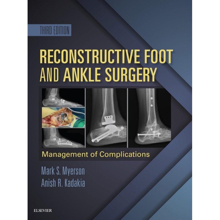 Reconstructive Foot and Ankle Surgery: Management of Complications, 3rd Edition