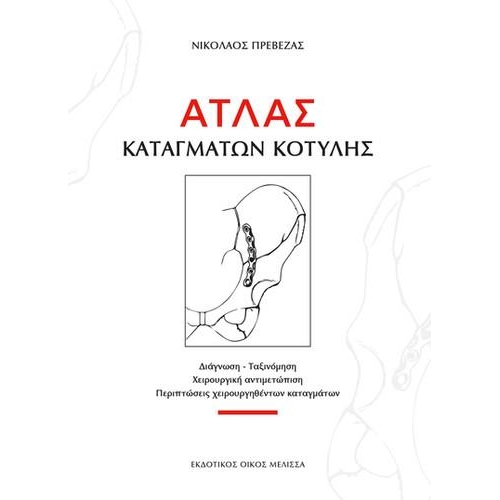 Άτλας Καταγμάτων Κοτύλης