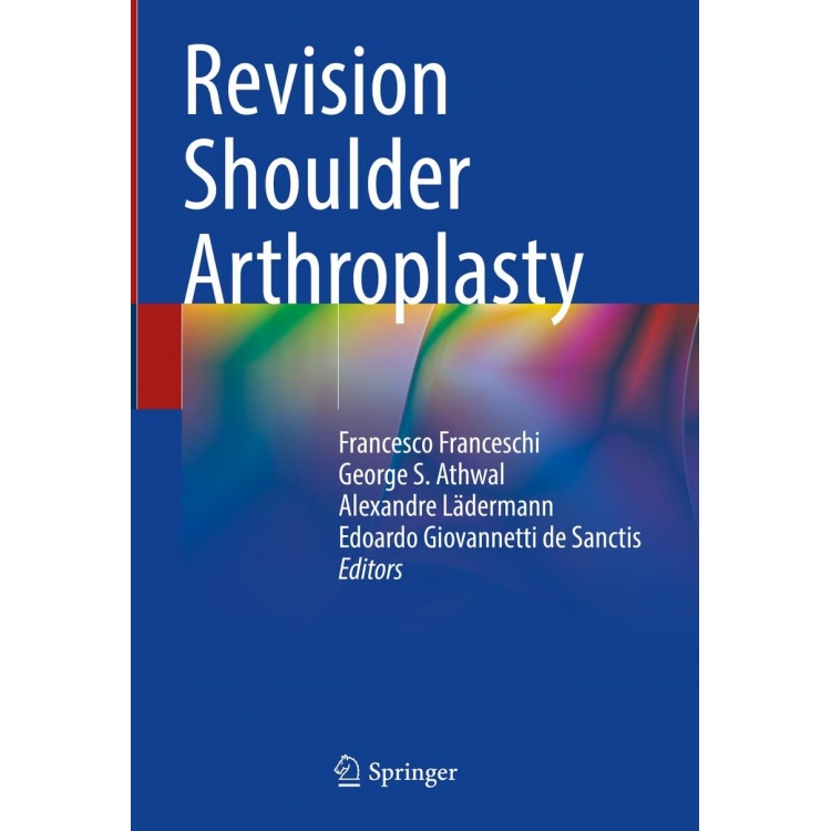 Revision Shoulder Arthroplasty