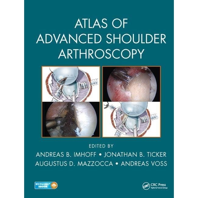 Atlas of Advanced Shoulder Arthroscopy