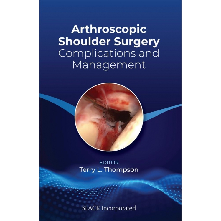 Arthroscopic Shoulder Surgery: Complications and Management