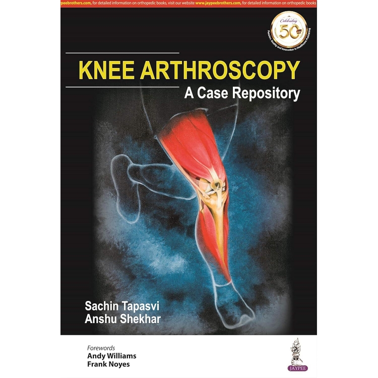 Knee Arthroscopy: A Case Repository