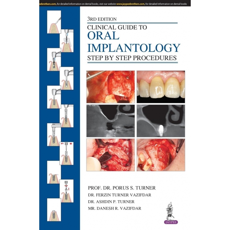 Clinical Guide to Oral Implantology: Step by Step Procedures, 3rd Edition