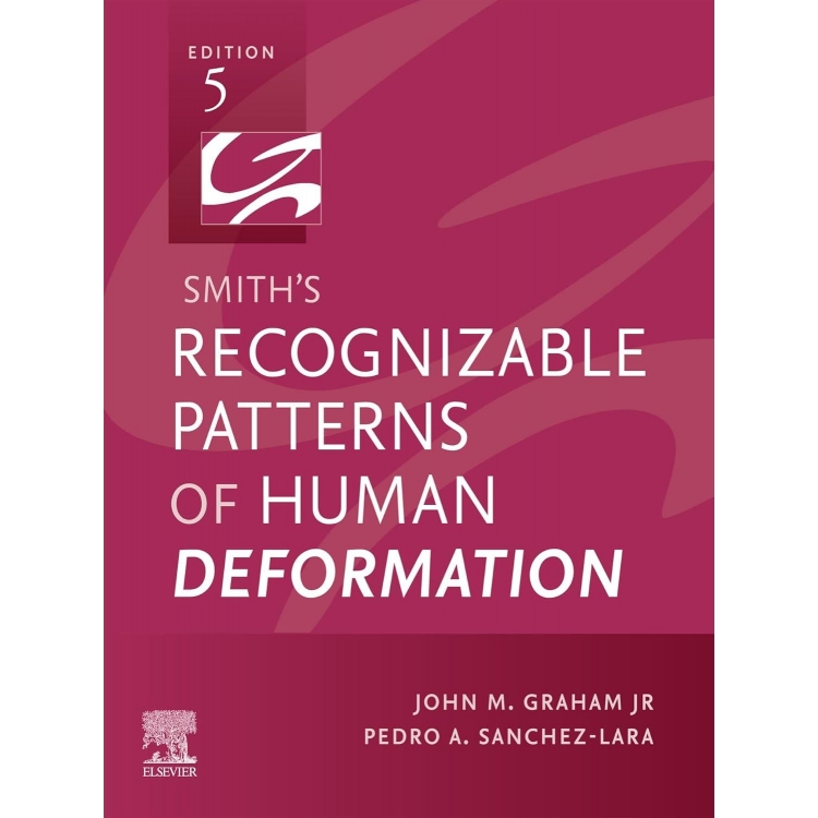 Smith`s Recognizable Patterns of Human Deformation, 5th Edition