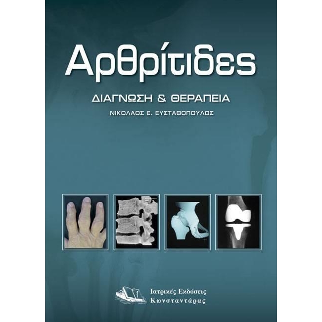 Αρθρίτιδες: Διάγνωση & Θεραπεία