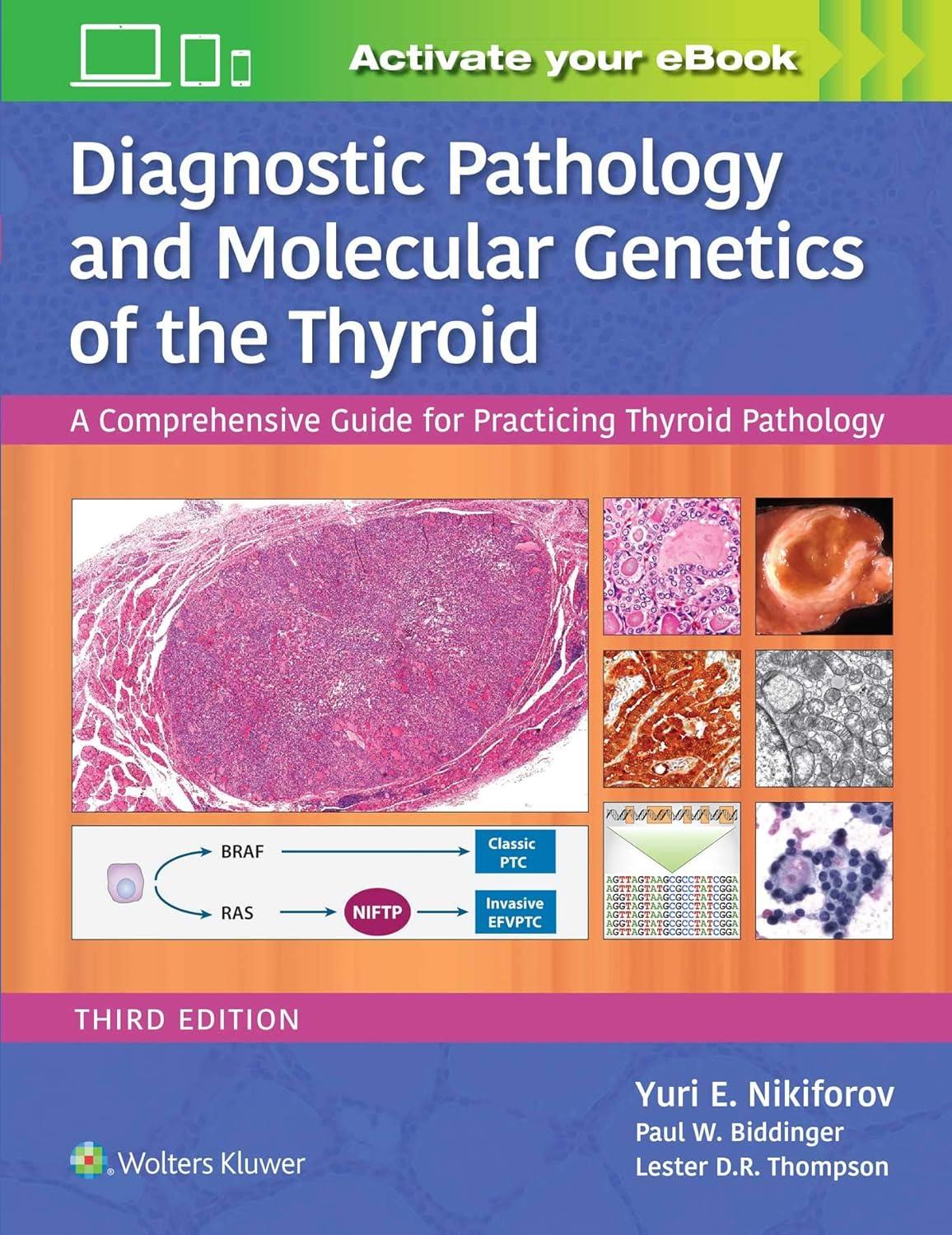Diagnostic Pathology and Molecular Genetics of the Thyroid: A Comprehensive Guide for Practicing Thyroid Pathology, 3rd Edition