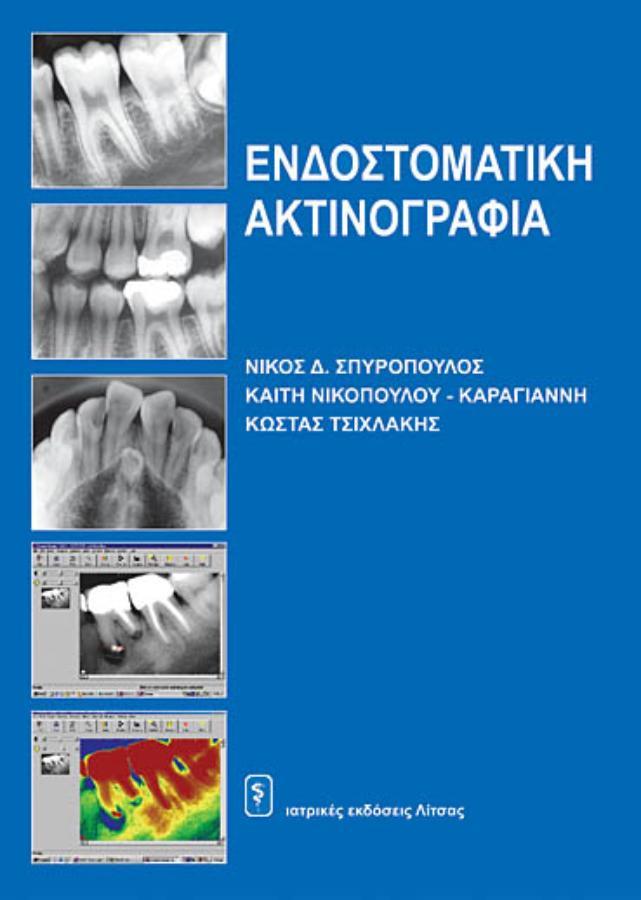 Ενδοστοματική Ακτινογραφία