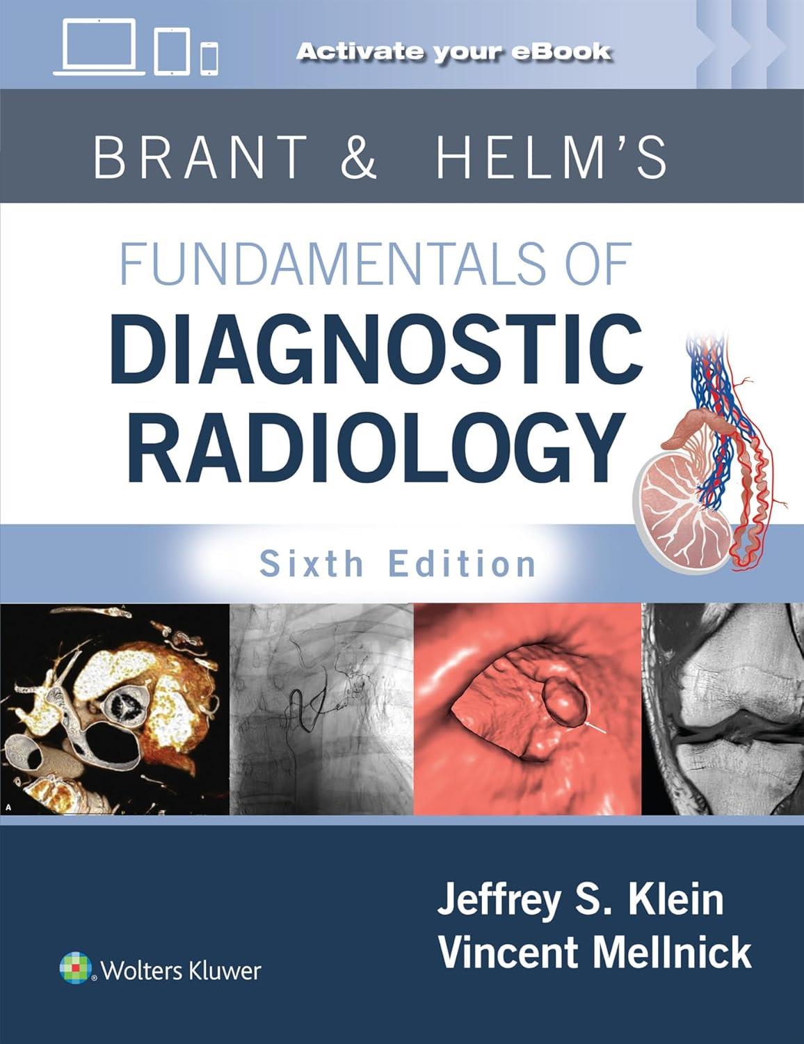Brant & Helm`s Fundamentals of Diagnostic Radiology, 6th Edition