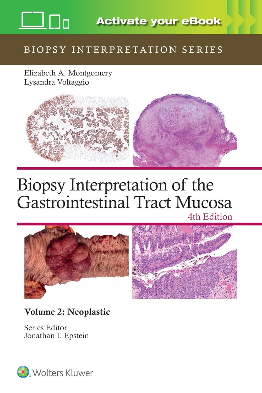 Biopsy Interpretation of the Gastrointestinal Tract Mucosa Volume 2: Neoplastic, 4th Edition