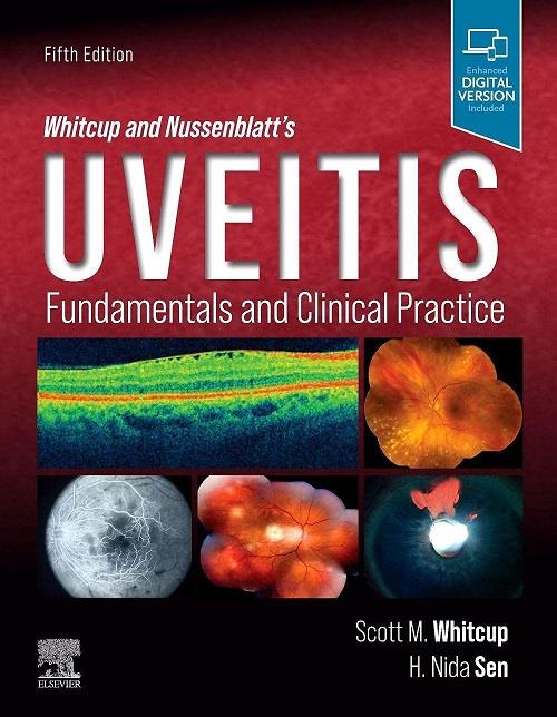 Whitcup and Nussenblatt`s Uveitis Fundamentals and Clinical Practice, 5th Edition