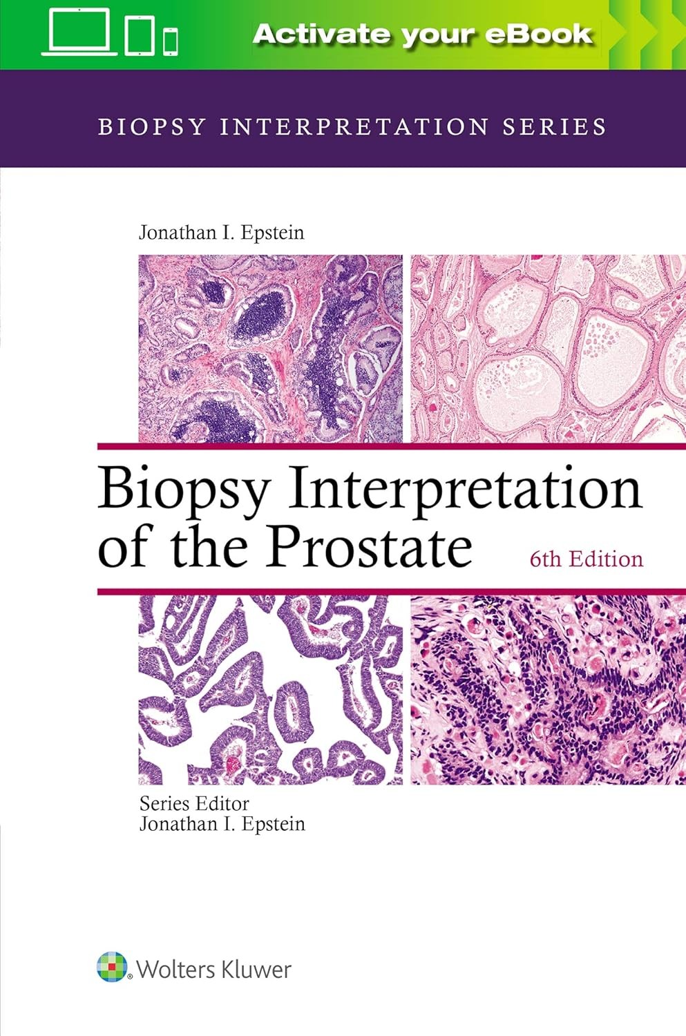Biopsy Interpretation of the Prostate, 6th Edition