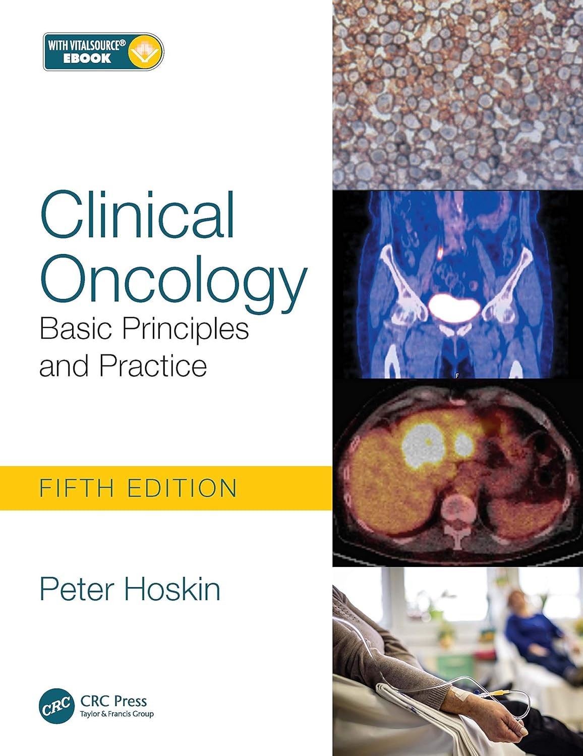 Clinical Oncology: Basic Principles and Practice, 5th Edition