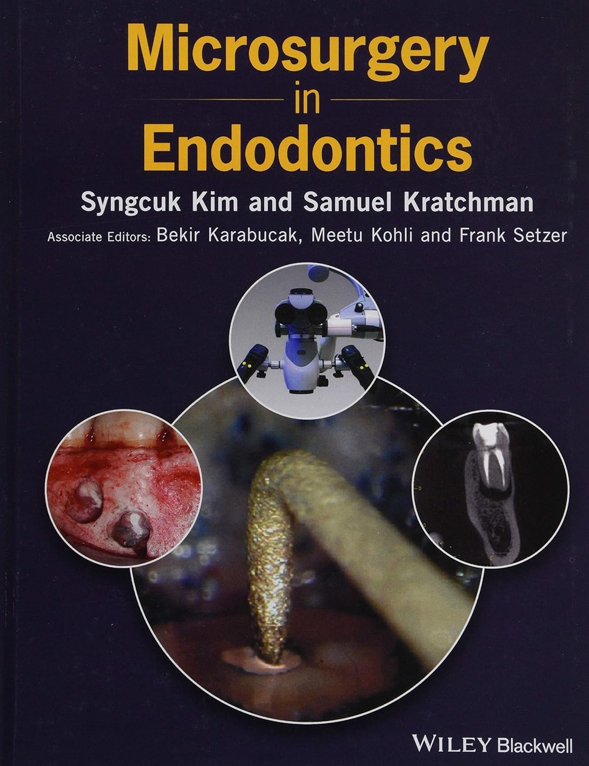 Microsurgery in Endodontics