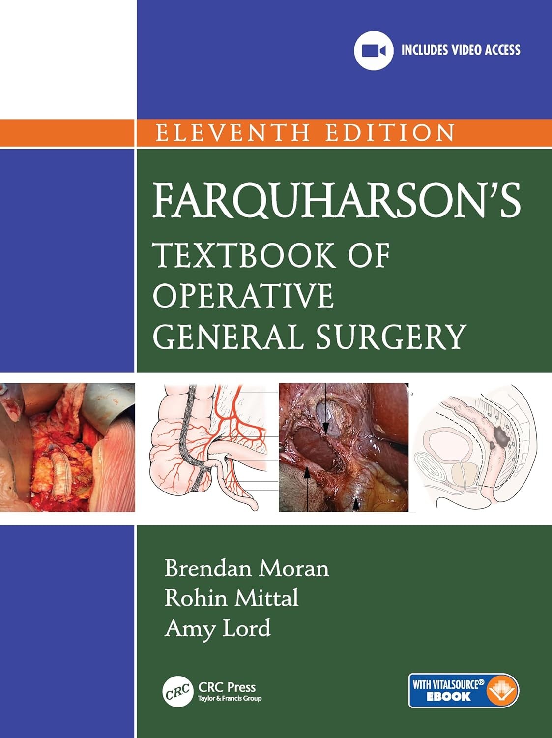 Farquharson`s Textbook of Operative General Surgery, 11th Edition