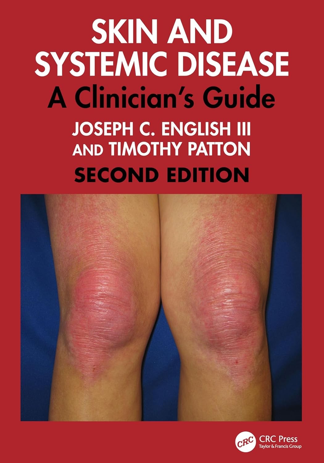 Skin and Systemic Disease: A Clinician`s Guide, 2nd Edition