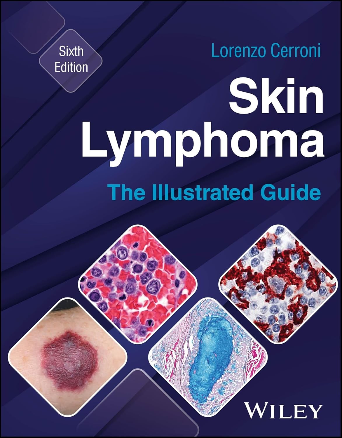 Skin Lymphoma: The Illustrated Guide, 6th Edition