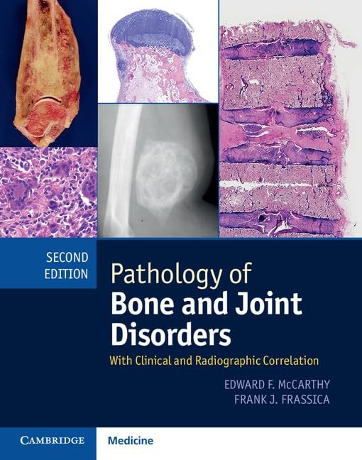 Pathology of Bone and Joint Disorders Print and Online Bundle: With Clinical and Radiographic Correlation, 2nd Edition