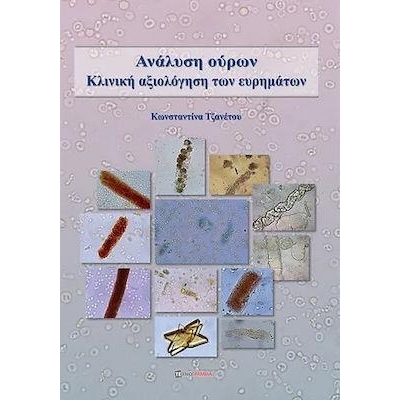 Ανάλυση ούρων κλινική αξιολόγηση των ευρημάτων