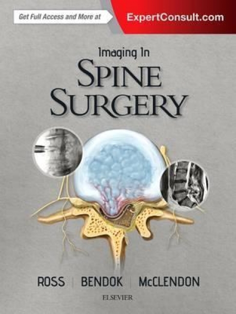 Imaging in Spine Surgery, 1st Edition