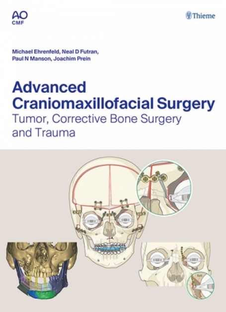Advanced Craniomaxillofacial Surgery: Tumor, Corrective Bone Surgery, and Trauma