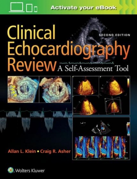 Clinical Echocardiography Review, 2nd Edition