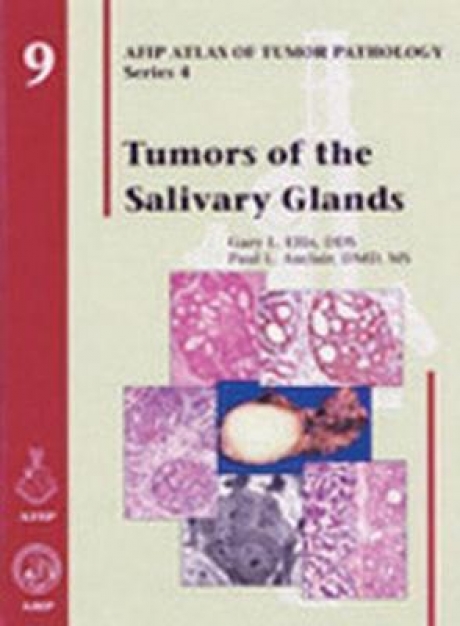 Tumors of the Salivary Glands, 1st Edition