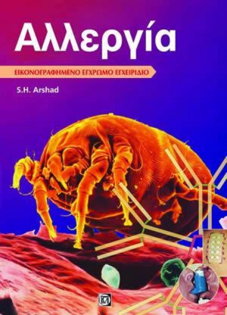 Αλλεργία