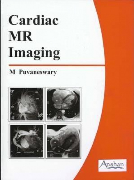 Cardiac MR Imaging, 1st Edition