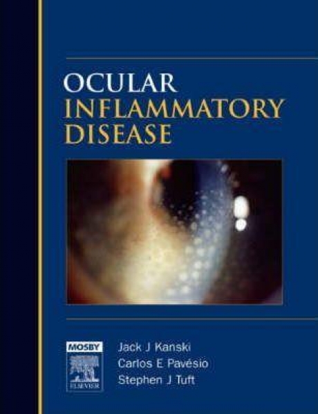 Ocular Inflammatory Disease, 1st Edition