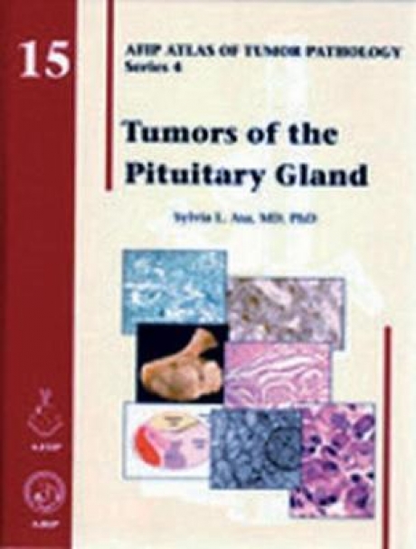 Tumors of the Pituitary Gland, 15th Edition