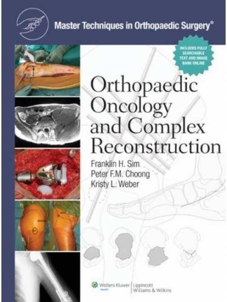 Master Techniques in Orthopaedic Surgery: Orthopaedic Oncology and Complex Reconstruction, 1st Edition