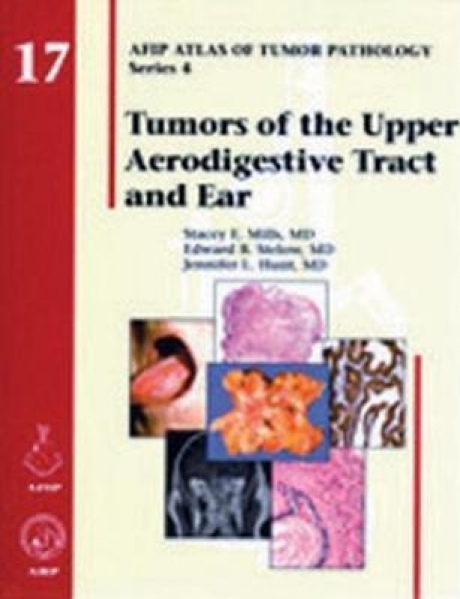 Tumors of the Upper Aerodigestive Tract and Ear, 1st Edition