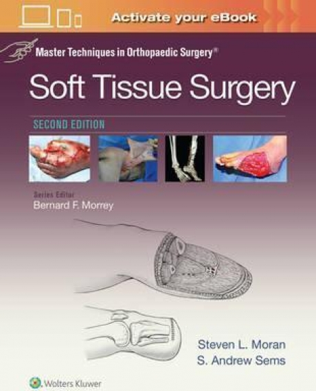 Master Techniques in Orthopaedic Surgery: Soft Tissue Surgery, 2nd Edition