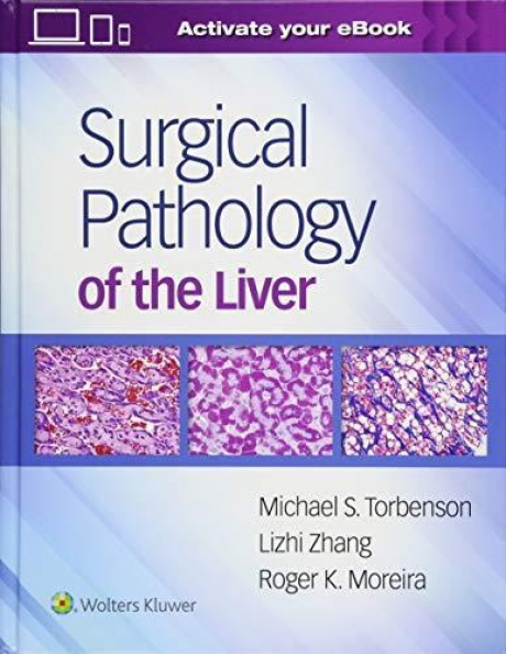 Surgical Pathology of the Liver, 1st Edition