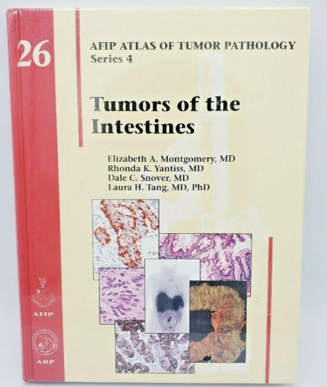 Tumors of the Intestines (Atlas of Tumor Pathology, Series 4, Number 26)