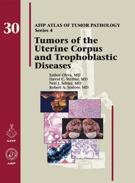 Tumors of the Uterine Corpus and Trophoblastic Diseases