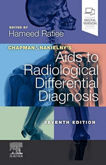 Chapman & Nakielny`s Aids to Radiological Differential Diagnosis, 7th Edition