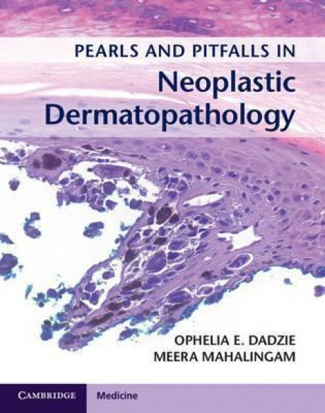 Pearls and Pitfalls in Neoplastic Dermatopathology with Online Access, 1st Edition