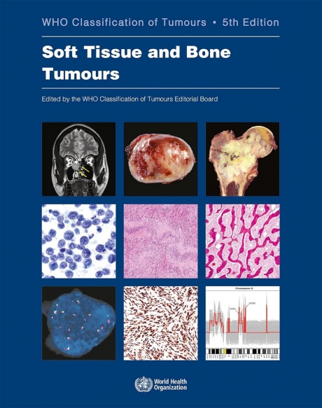 Soft Tissue and Bone Tumours: WHO Classification of Tumours, 5th Edition