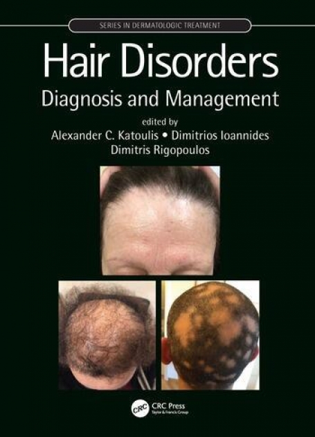 Hair Disorders Diagnosis and Management
