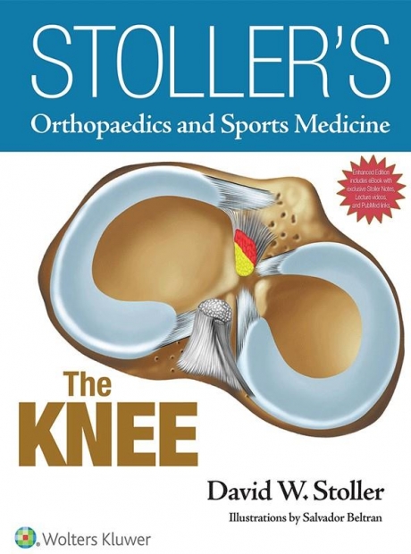Stoller`s Orthopaedics and Sports Medicine: The Knee, 1st Edition (Includes Stoller Lecture Videos and Stoller Notes)