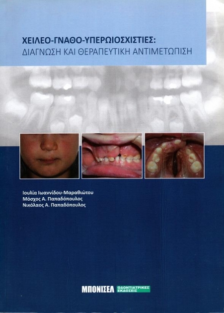 Χειλέο-Γνάθο-Υπερωιοσχιστίες Διάγνωση και Θεραπευτική