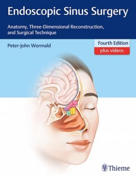 Endoscopic Sinus Surgery 4th edition